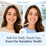 Precision Teeth Whitening Pen thumbnail