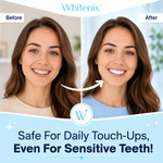 Precision Teeth Whitening Pen thumbnail